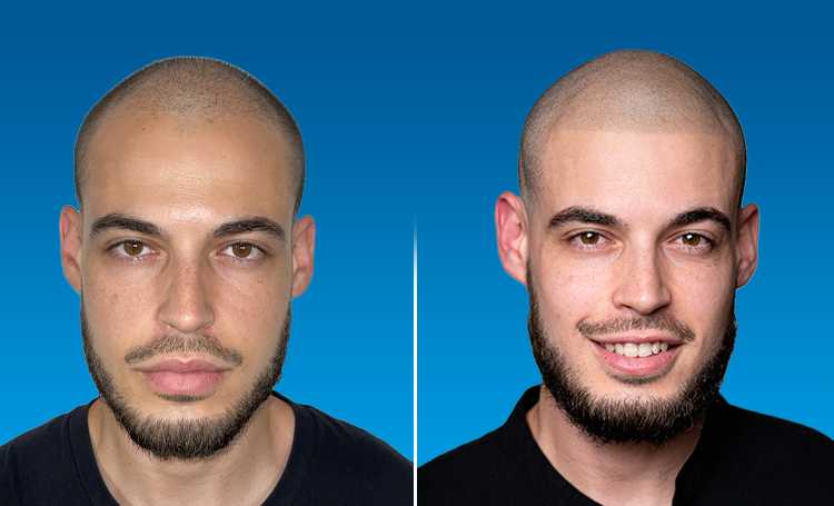 edge+up
