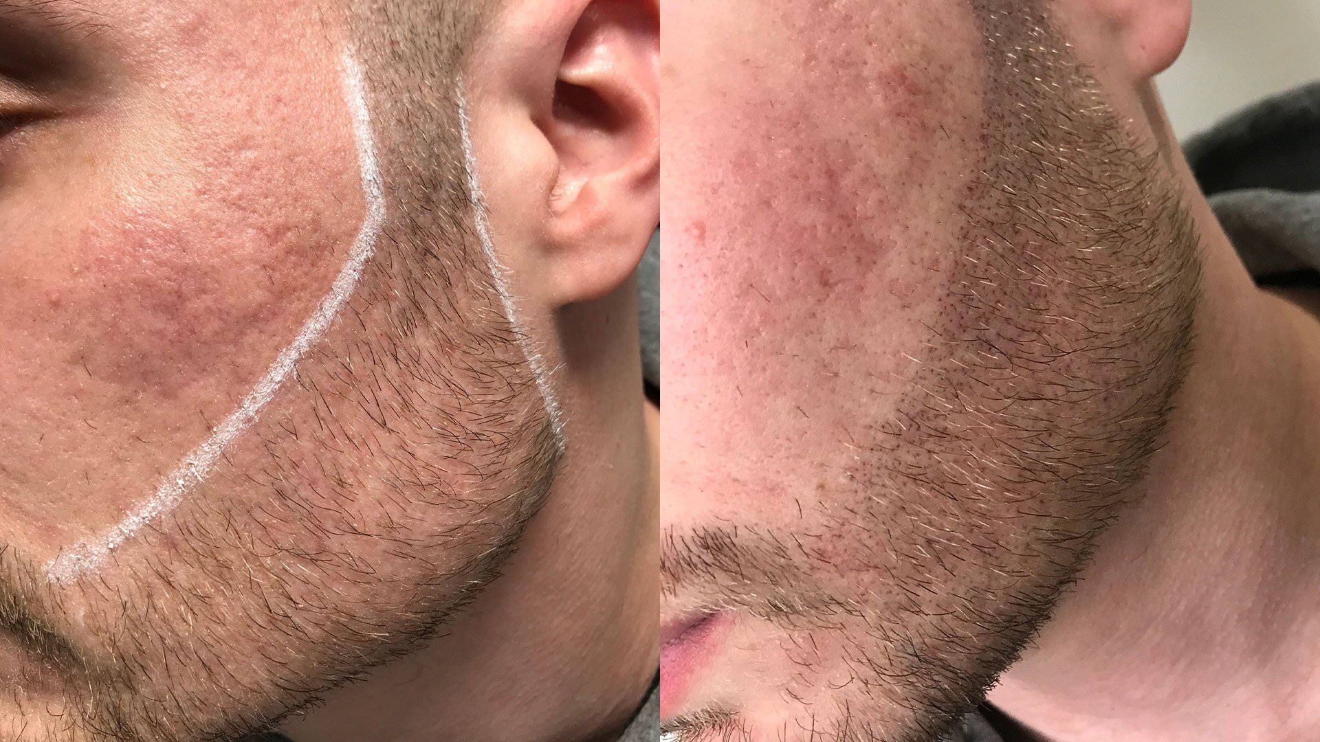 fullnessbeards